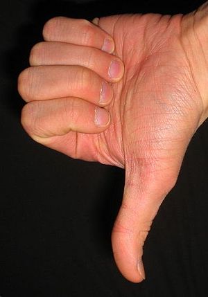 300px Thumbs down Your Small Business and Negative Comments