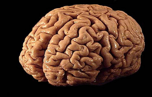 Alzheimer's Breakthrough: Replicating Brain Cells