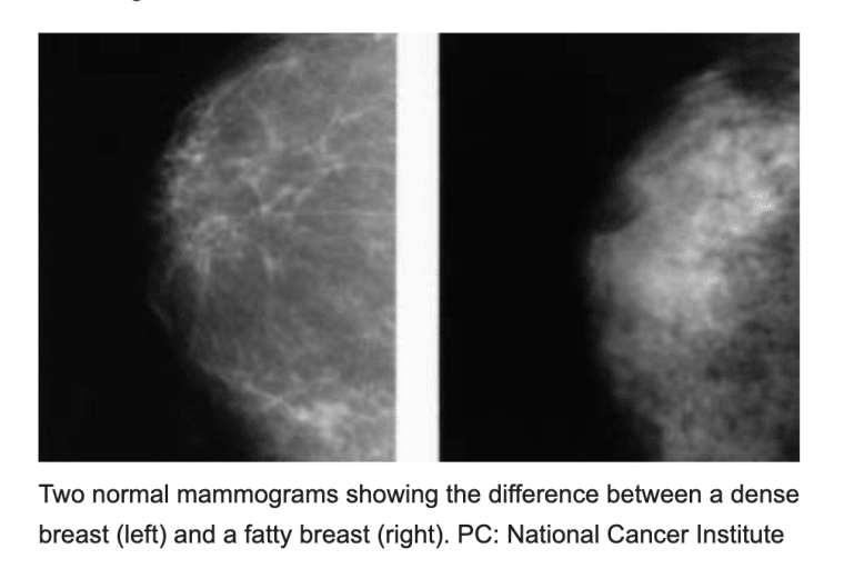 Cancer detection scans